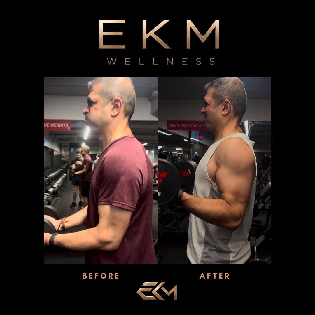 EKM Wellness client before and after body transformation, side profile